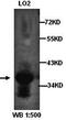 TNF Receptor Superfamily Member 11b antibody, orb77276, Biorbyt, Western Blot image 