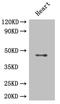 Histone Deacetylase 3 antibody, A68305-100, Epigentek, Western Blot image 