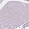 Zinc Finger CCCH-Type Containing 14 antibody, HPA049798, Atlas Antibodies, Immunohistochemistry paraffin image 