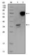HPS1 antibody, A05026, Boster Biological Technology, Western Blot image 