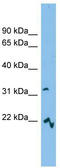 Solute Carrier Family 25 Member 53 antibody, TA336105, Origene, Western Blot image 