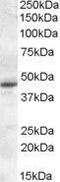Melatonin Receptor 1A antibody, GTX31054, GeneTex, Western Blot image 