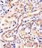 BTB/POZ domain-containing protein KCTD11 antibody, M10796, Boster Biological Technology, Immunohistochemistry paraffin image 