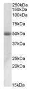 Aldehyde Dehydrogenase 1 Family Member A1 antibody, AP31101PU-N, Origene, Western Blot image 
