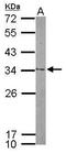 Nucleolar Protein 12 antibody, GTX120303, GeneTex, Western Blot image 