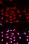 ABL Proto-Oncogene 1, Non-Receptor Tyrosine Kinase antibody, MBS125530, MyBioSource, Immunofluorescence image 