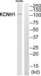 Potassium voltage-gated channel subfamily H member 1 antibody, abx014731, Abbexa, Western Blot image 