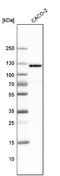 Ras Protein Specific Guanine Nucleotide Releasing Factor 2 antibody, NBP1-83331, Novus Biologicals, Western Blot image 