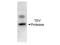 P1 protease antibody, NBP1-97669, Novus Biologicals, Western Blot image 