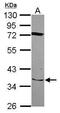 Solute Carrier Family 25 Member 28 antibody, PA5-31839, Invitrogen Antibodies, Western Blot image 