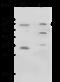 NADPH oxidase 4 antibody, 102385-T32, Sino Biological, Western Blot image 