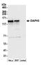 DRF3 antibody, A305-165A, Bethyl Labs, Western Blot image 
