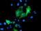 Protein Tyrosine Phosphatase Non-Receptor Type 7 antibody, M07600-1, Boster Biological Technology, Immunofluorescence image 