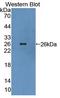 BCR Activator Of RhoGEF And GTPase antibody, LS-C374433, Lifespan Biosciences, Western Blot image 