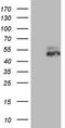 Nuclear receptor ROR-beta antibody, LS-C791068, Lifespan Biosciences, Western Blot image 