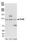 Phosphorylase Kinase Regulatory Subunit Beta antibody, A304-881A, Bethyl Labs, Western Blot image 