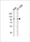 ADAM Metallopeptidase With Thrombospondin Type 1 Motif 6 antibody, PA5-49446, Invitrogen Antibodies, Western Blot image 