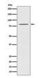 OPA1 Mitochondrial Dynamin Like GTPase antibody, M00508, Boster Biological Technology, Western Blot image 