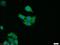 Ras-related protein Rab-3B antibody, 15774-1-AP, Proteintech Group, Immunofluorescence image 