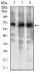ATP Binding Cassette Subfamily G Member 5 antibody, GTX60788, GeneTex, Western Blot image 