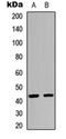Coagulation Factor XI antibody, orb234839, Biorbyt, Western Blot image 