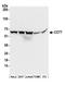 Chaperonin Containing TCP1 Subunit 7 antibody, A304-730A, Bethyl Labs, Western Blot image 