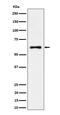 Eyes absent homolog 2 antibody, M05074, Boster Biological Technology, Western Blot image 