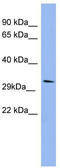RRAD, Ras Related Glycolysis Inhibitor And Calcium Channel Regulator antibody, TA342213, Origene, Western Blot image 