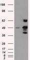 Proteasome 26S Subunit, ATPase 3 antibody, NBP2-02316, Novus Biologicals, Western Blot image 