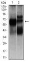 Beta-hexosaminidase subunit alpha antibody, MA5-17089, Invitrogen Antibodies, Western Blot image 