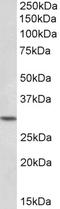 Homeobox protein Hox-C8 antibody, STJ72359, St John