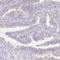 Zinc Finger B-Box Domain Containing antibody, NBP1-82092, Novus Biologicals, Immunohistochemistry frozen image 