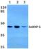 Heterogeneous nuclear ribonucleoprotein G antibody, GTX66670, GeneTex, Western Blot image 