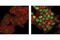 p53 antibody, 2521S, Cell Signaling Technology, Immunofluorescence image 