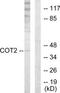 Nuclear Receptor Subfamily 2 Group F Member 2 antibody, TA314613, Origene, Western Blot image 