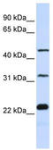 Family With Sequence Similarity 153 Member B antibody, TA339982, Origene, Western Blot image 