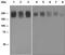 NPC Intracellular Cholesterol Transporter 1 antibody, ab134113, Abcam, Western Blot image 