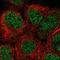 Solute Carrier Family 29 Member 2 antibody, NBP1-85253, Novus Biologicals, Immunocytochemistry image 