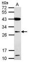 IMP U3 Small Nucleolar Ribonucleoprotein 4 antibody, GTX120864, GeneTex, Western Blot image 
