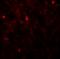 Acyl-CoA Oxidase 3, Pristanoyl antibody, orb69795, Biorbyt, Immunofluorescence image 