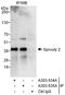 Sprouty RTK Signaling Antagonist 2 antibody, A303-535A, Bethyl Labs, Immunoprecipitation image 