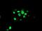 ATR-interacting protein antibody, NBP2-02004, Novus Biologicals, Immunocytochemistry image 