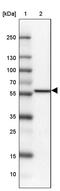Regulator Of MON1-CCZ1 antibody, PA5-60428, Invitrogen Antibodies, Western Blot image 