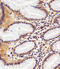 Rac Family Small GTPase 1 antibody, M00041-1, Boster Biological Technology, Immunohistochemistry paraffin image 