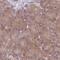 Prefoldin subunit 6 antibody, PA5-61657, Invitrogen Antibodies, Immunohistochemistry paraffin image 