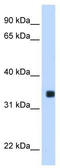 Max-like protein X antibody, TA333463, Origene, Western Blot image 