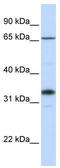 Beta-1,3-Galactosyltransferase 1 antibody, TA338451, Origene, Western Blot image 
