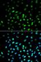 Serine/Threonine Kinase 11 antibody, LS-B11921, Lifespan Biosciences, Immunofluorescence image 