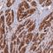 Coiled-Coil Domain Containing 154 antibody, NBP2-30875, Novus Biologicals, Immunohistochemistry paraffin image 