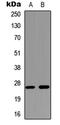 Aquaporin 2 antibody, LS-B14083, Lifespan Biosciences, Western Blot image 